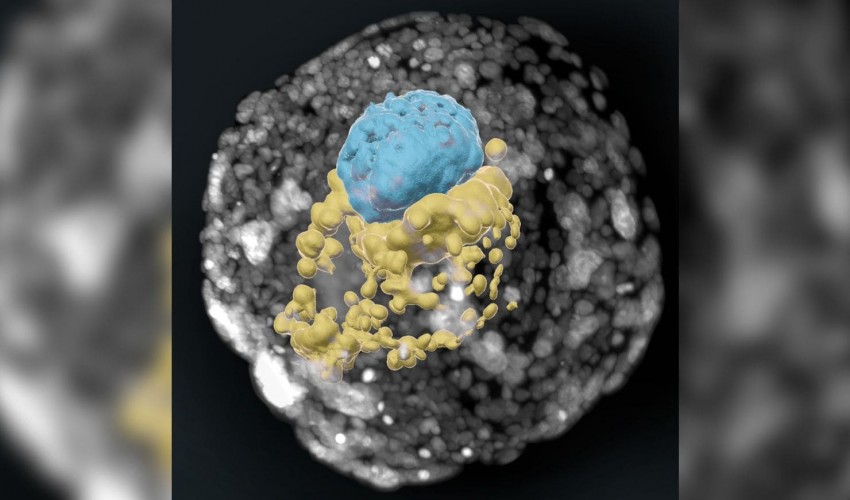 Breakthrough in Human Embryo Modeling: Balancing Scientific Progress and Ethical Concerns
